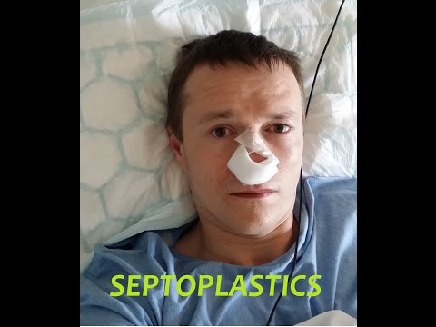 Септопластика: операция на нос. Решился!