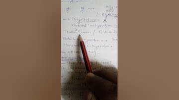 EE 307 U-3 Effect of sag on overhead conductor configuration and their spacing By Ghanshyam Singaria