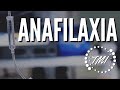 Anafilaxia | Diagnóstico y Manejo