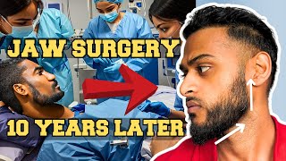 Jaw Underbite Surgery - 10 YEARS LATER