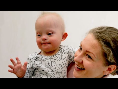 Why Richard Dawkins Says to Abort Down Syndrome Kids