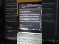 75 code hard day 13 Easy #coding #codingchallenge #interviewshorts #apnacollge #leetcode