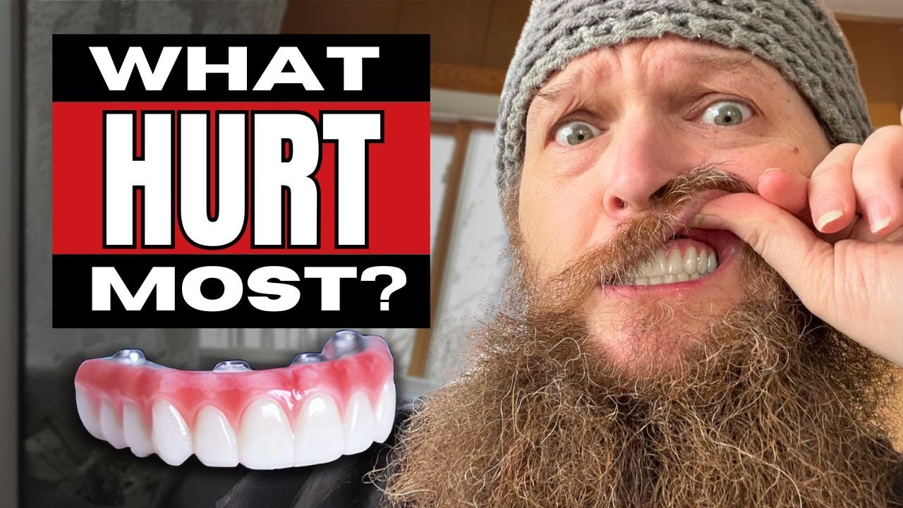 I Got New Teeth in 24 Hours, But Let’s Talk About the Pain