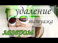 УДАЛЕНИЕ ТАТУАЖА ЛАЗЕРОМ. СКОЛЬКО Я НОШУ ПЕРМАНЕНТНЫЙ МАКИЯЖ, КАК  УДАЛИТЬ ЛАЗЕРОМ /МОЙ ОПЫТ/.