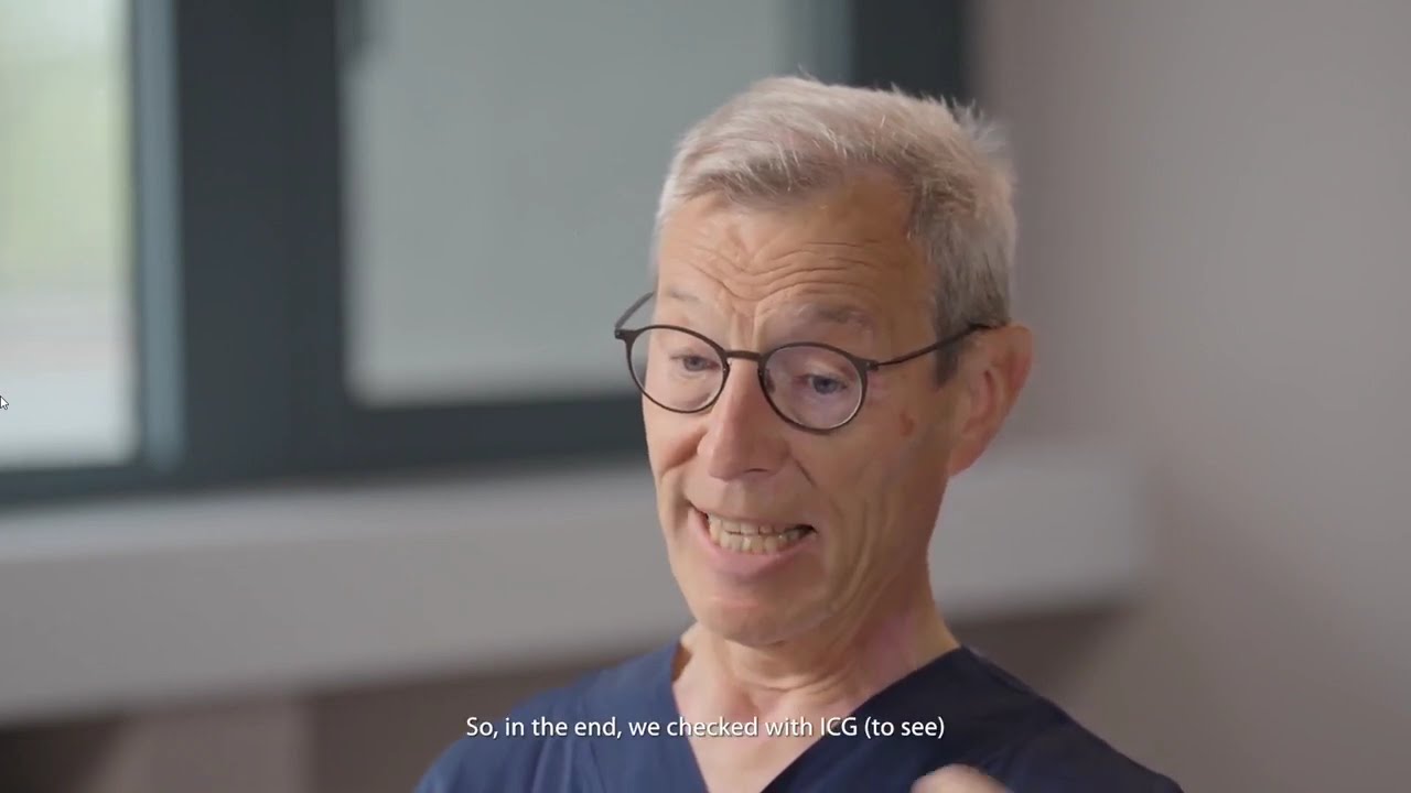 Endoscope Mindray  (HD3, UX3, UX5) - отзывы хирургов