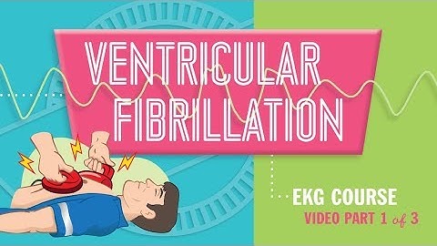 Ventricular fibrillation ( VF or V fib ) part 1 of 3 causes, symptoms & pathophysiology