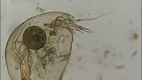 C Elegans under Microscope