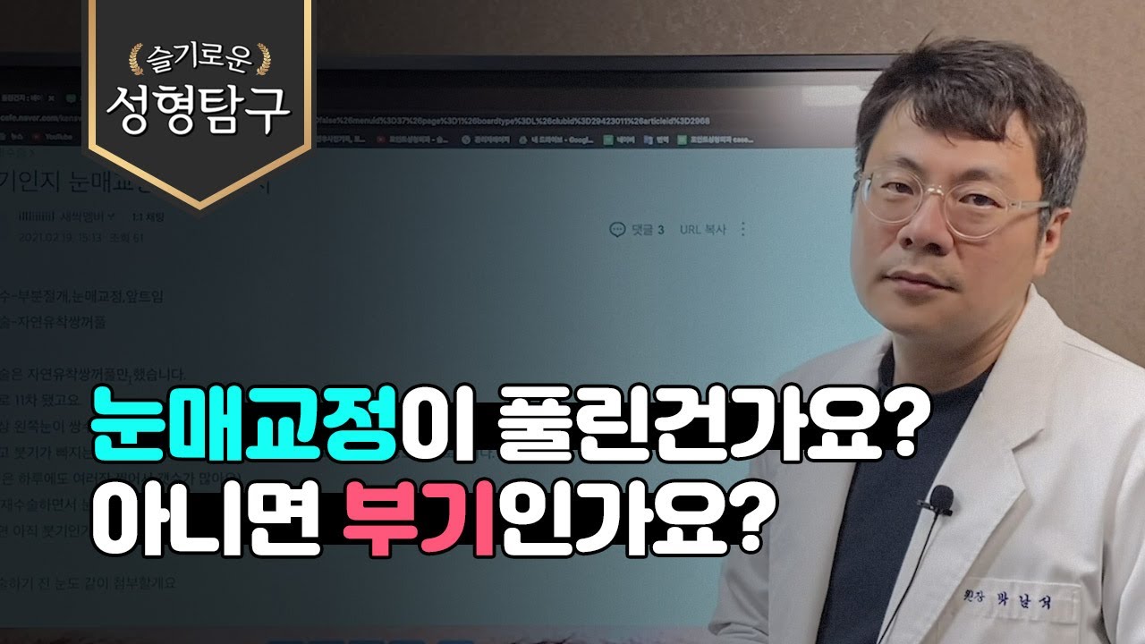 Q. 눈매교정이 풀린건가요? 아니면 부기인가요?