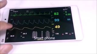 Patient monitor for PC/Phone/VR