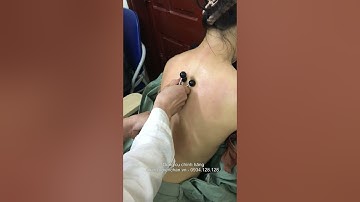 Tuyệt chiêu nắn chỉnh khai thông lưng   Hỏa tiễn