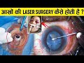 ऑपरेशन कराने वाले हो तो देख लो कैसे होती है आंखों की लेजर सर्जरी How laser eye surgery is done ?