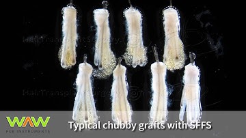 WAW FUE Foot Pedal and Hybrid Trumpet Punch in practice (Devroye