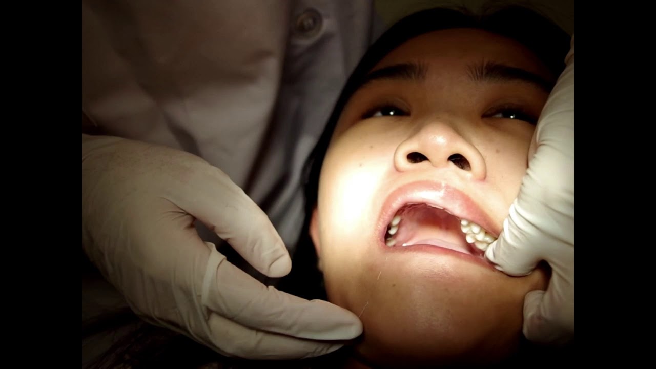 1. Oral examination process YouTube