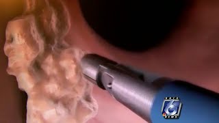 Colonoscopy could potentially save your life
