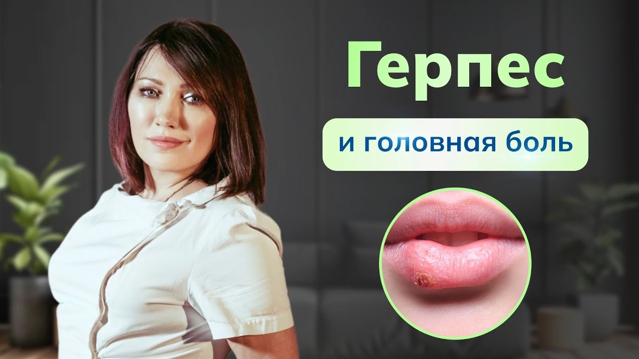 Герпес и головная боль? Почему хроническая головная боль часто связана с герпесом? Смотрите видео