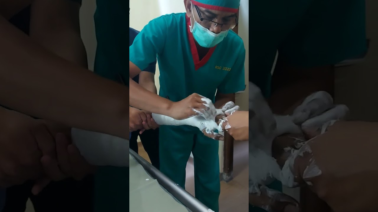 CARA MASANG GIPS PADA PATAH TULANG# short