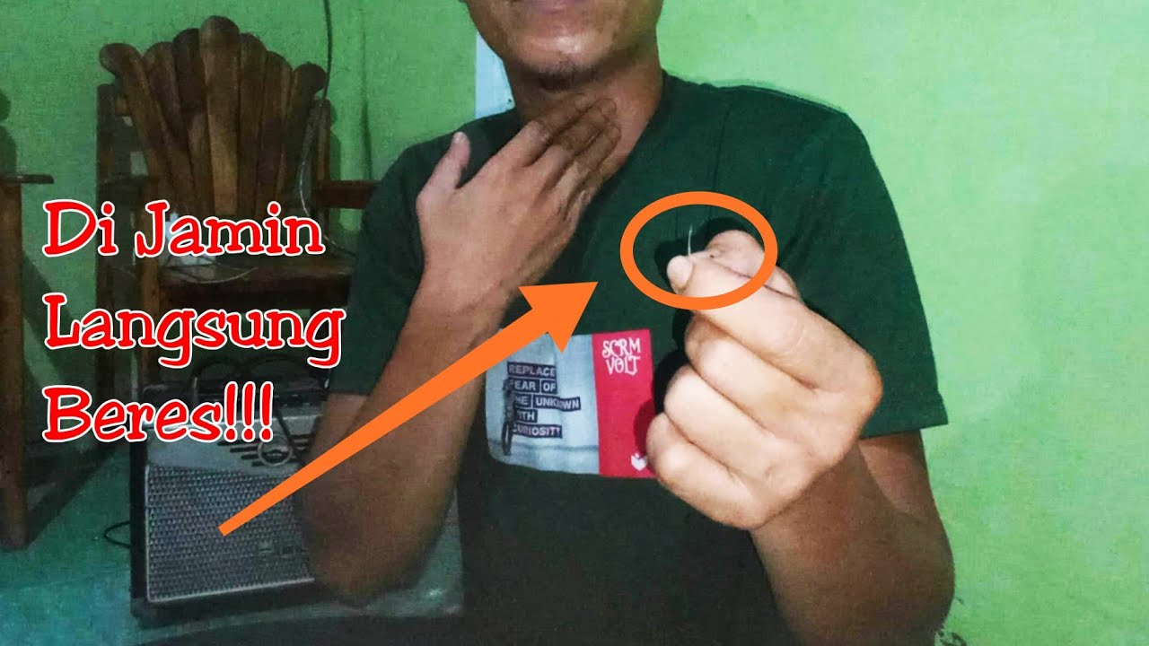 Hanya Dari Orang Yang Tahu Cara Ini Cara Mengatasi Duri Ikan