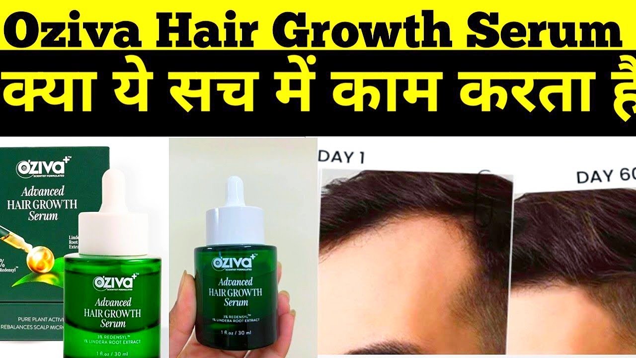 Oziva advanced hair growth serum review | oziva Hair Growth Serum honest review 