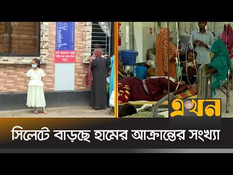 সিলেটে বাড়ছে হামের আক্রান্তের সংখ্যা, আক্রান্তদের বেশিরভাগই শিশু | Sylhet News | Ekhon TV