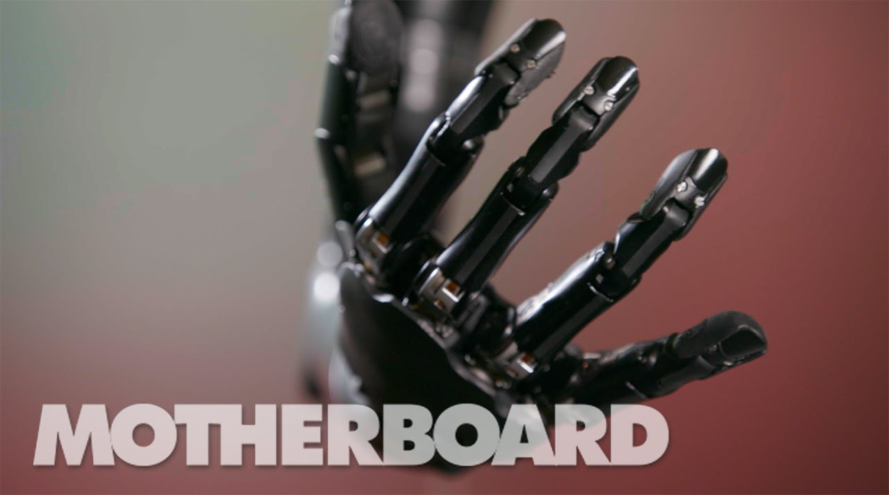 Woman receives bionic hand with sense of touch