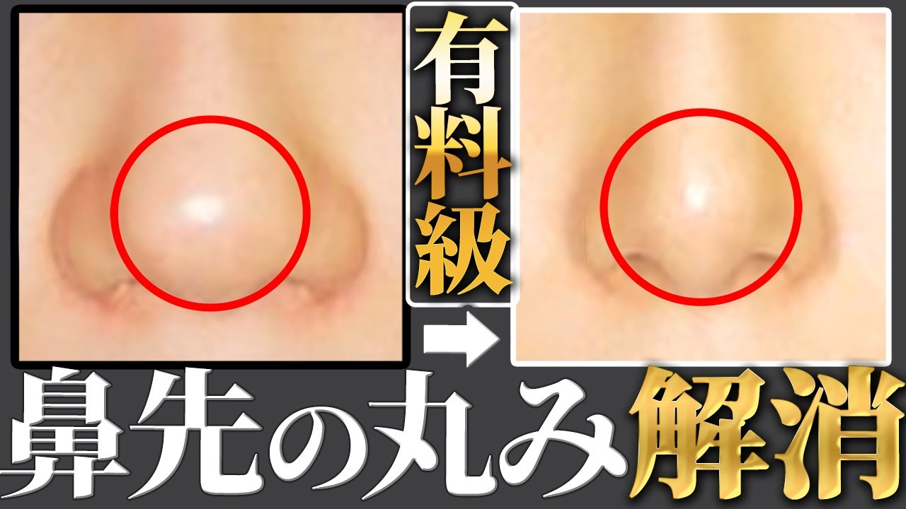 Устранение округлости кончика носа Носовая кость Носовая мышца