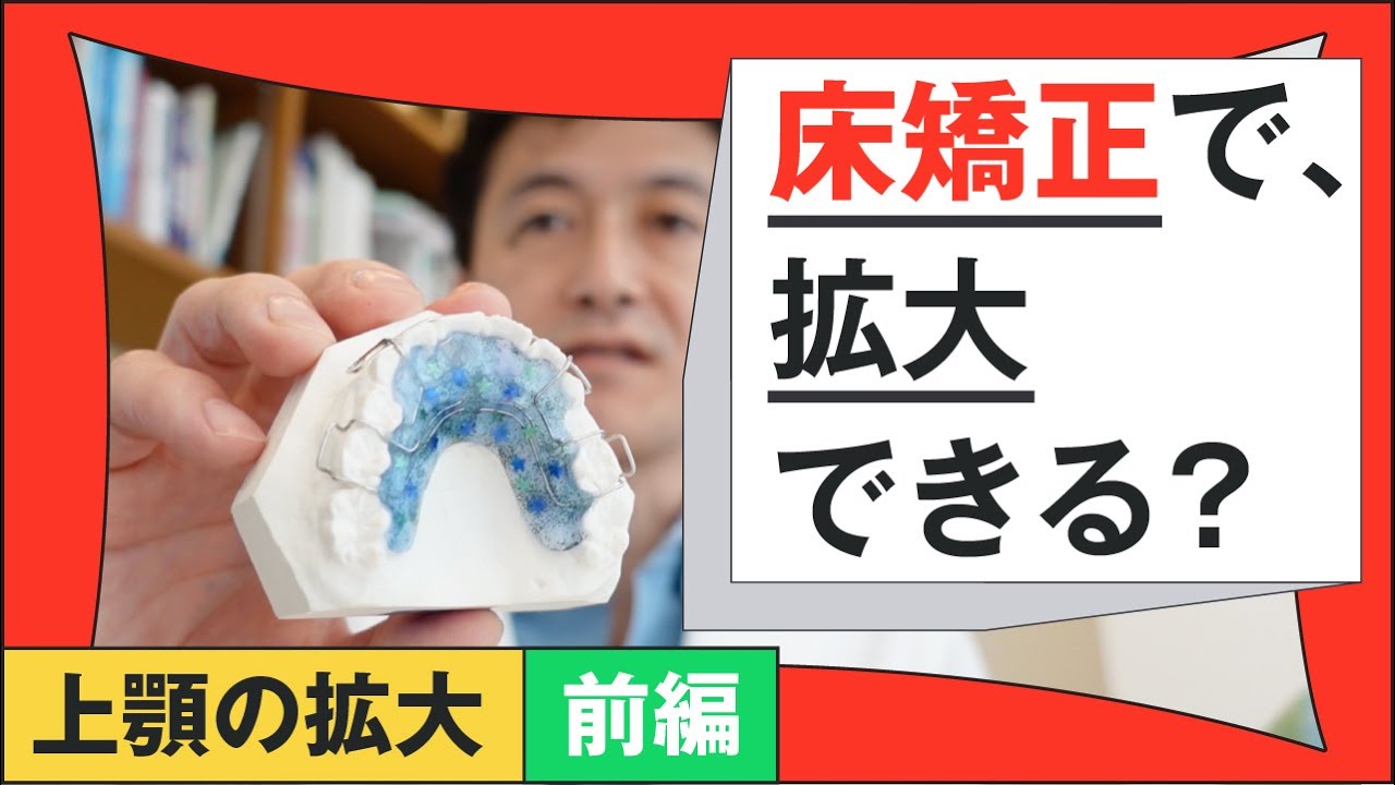 床矯正で拡大？：上顎の拡大前編