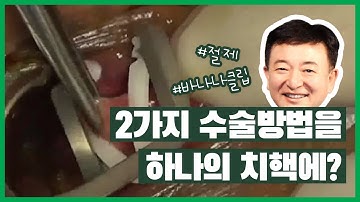 [치질수술]4도내치핵에 바나나클립과 절제를 혼합하는 술식