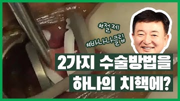 [치질수술]4도내치핵에 바나나클립과 절제를 혼합하는 술식