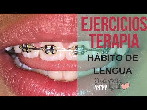 Vídeo: Ejercicios De Postura De La Lengua Y Cómo Pueden Afectar Sus Pómulos