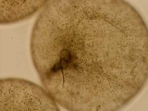 Noctiluca scintillans having spoon like flagella