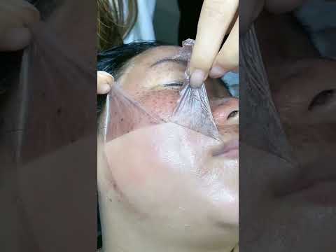 Vidéo: Comment préparer la peau pour un peeling chimique : 13 étapes (avec photos)