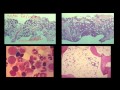 Blood Cells and Bone Marrow (Part 2 of 2)