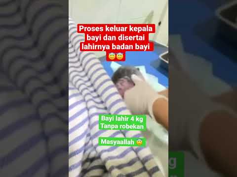 Detik-detik bayi perempuan lahir langsung menangis