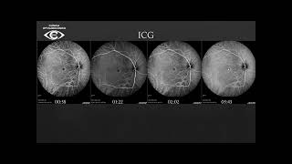 Reunião Retina 25.07.2024