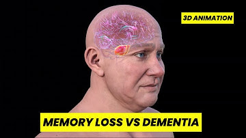 Memory Loss vs Dementia – Your Brain Revealed in 3D