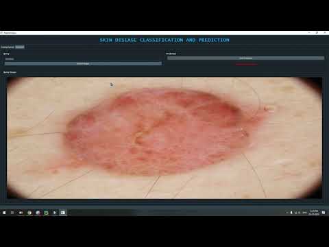 SKIN DISEASE CLASSIFICATION PYTORCH GUI | Machine Learning | Deep Learning | Python Project