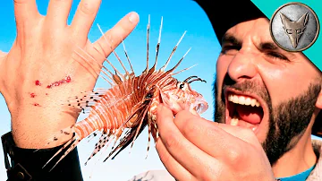 STUNG by a LIONFISH!