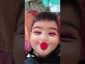 #🙈🙈🙈