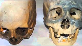 Police Find Owner Of 2 Human Skulls Found At Transfer Station In Stamford; Skulls Taken To ...