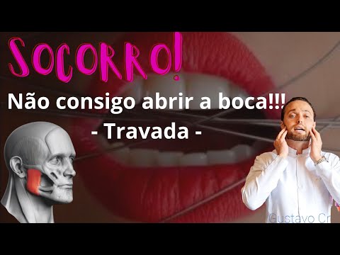 Vídeo: Meu maxilar ficará travado para sempre?