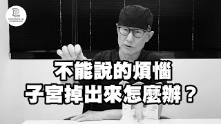 【EP56】不能說的煩惱,子宮掉出來怎麼辦?