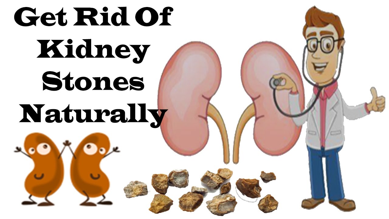 No Need To Surgery - Only One Ingredient Can Take Out Your Kidney Stones - YouTube