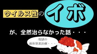 ストレスの影響？ウイルス性のイボが全然治らなかった話