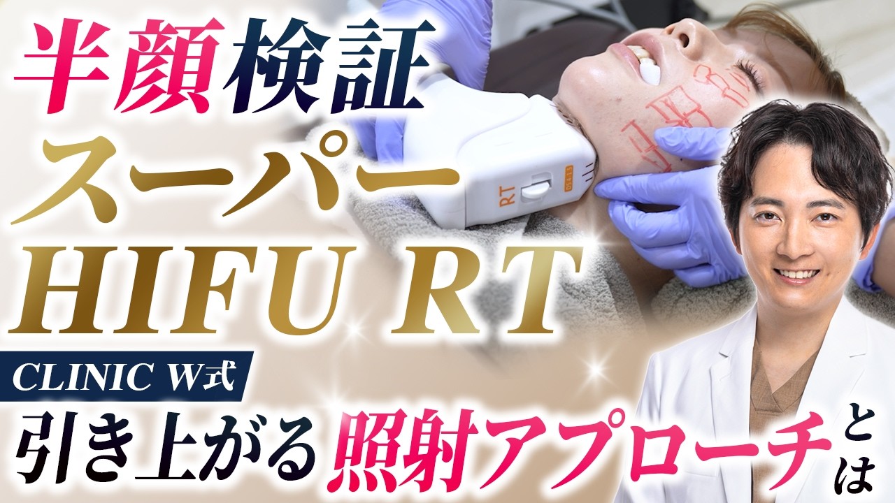 スーパーHIFU RT半顔検証 CLINIC W式 引き上がる照射アプローチ