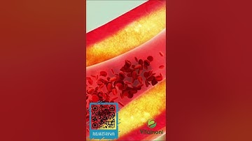 Nước Cốt Nhàu Vitalnoni Giảm Cholesterol