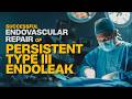 Successful Endovascular Repair of Persistent Type III Endoleak | Medicover Hospitals