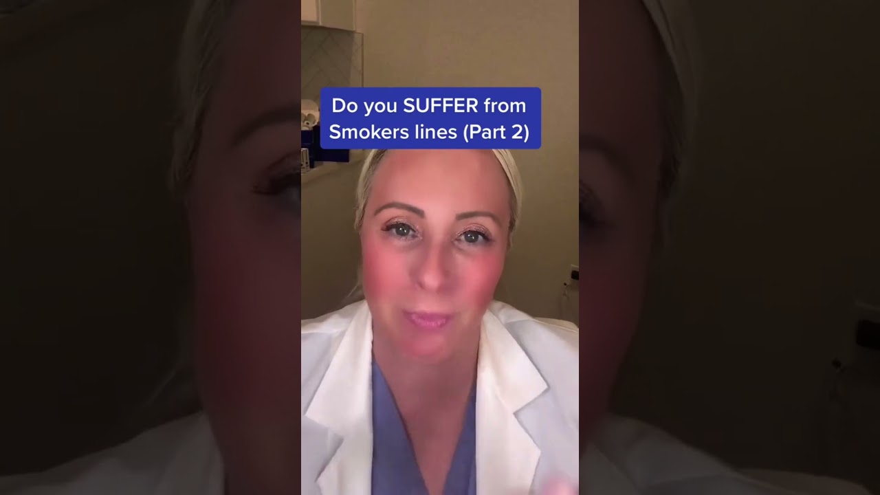 How to treat smokers lines with #botoxandfiller #smokerslines #smokerslinestreatment #smokerslinespr