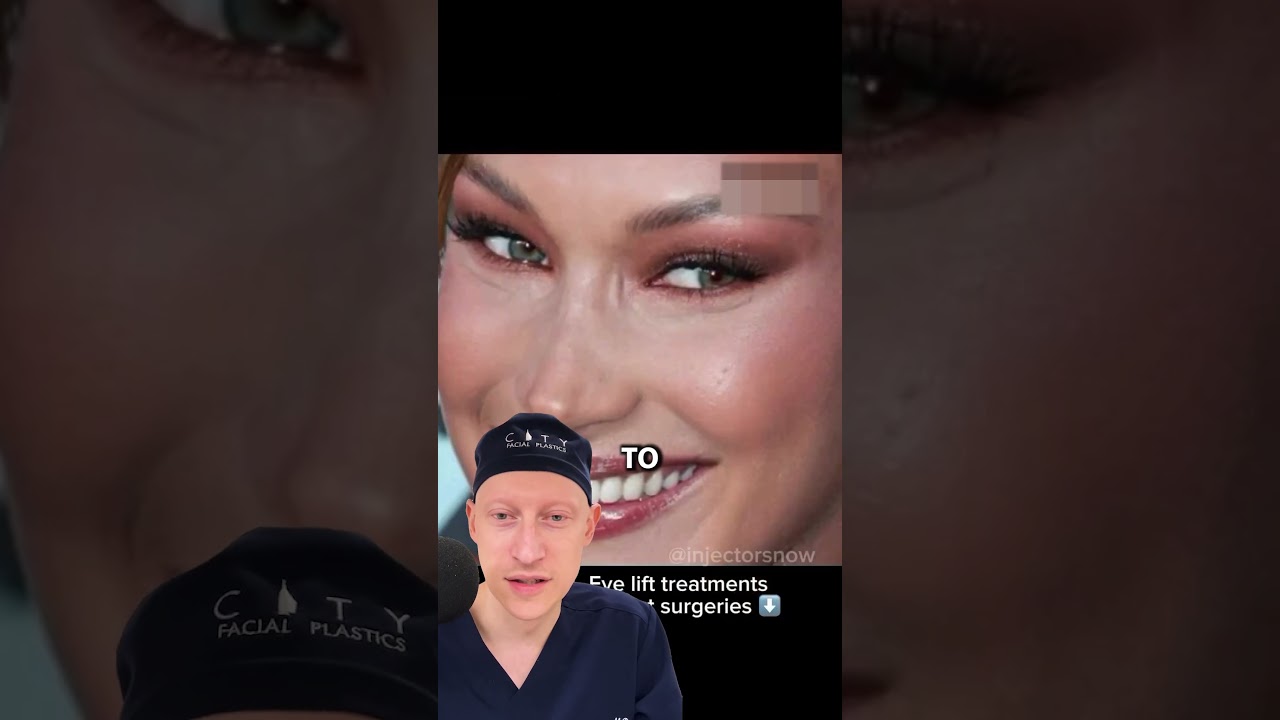 Upper Eyelid Surgery In Hollywood