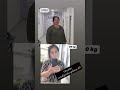 Bariatriya #surgery #tashkent #bariatric #bariatricsurgery #ozish...