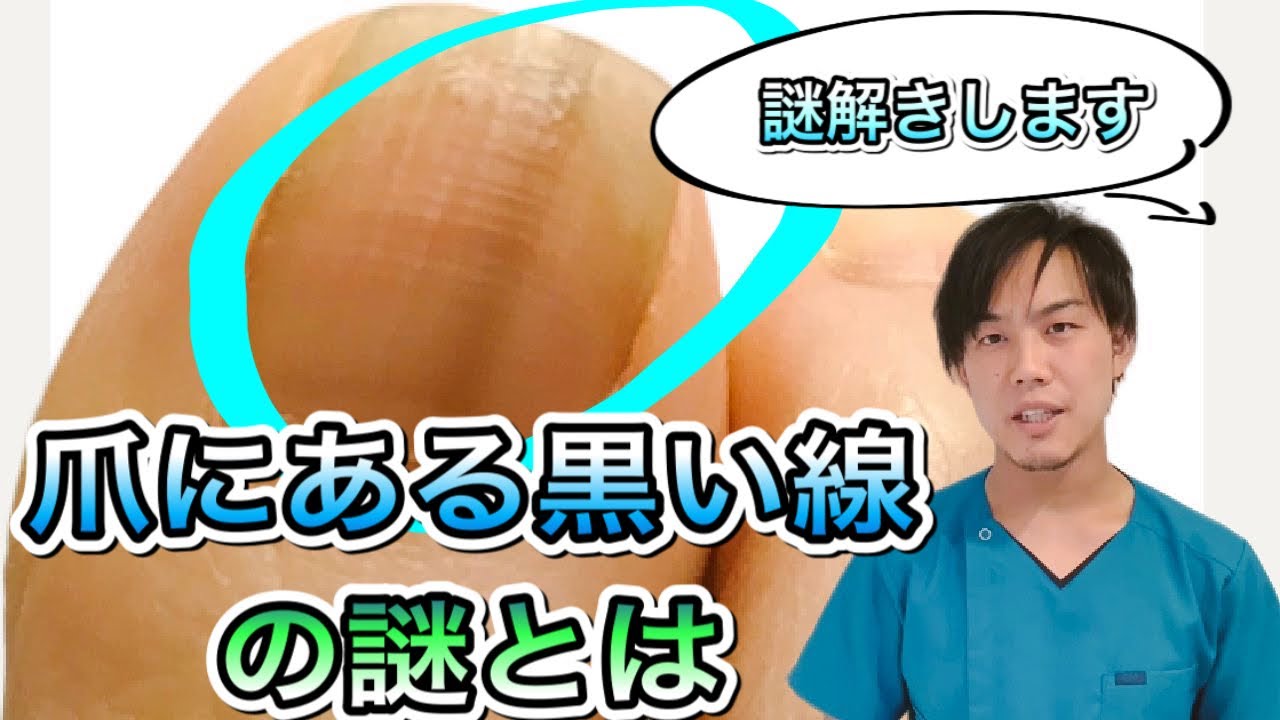 爪にある黒い線の謎 Youtube
